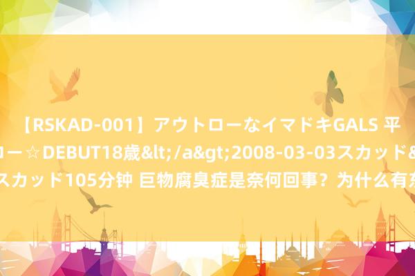 【RSKAD-001】アウトローなイマドキGALS 平成生まれ アウトロー☆DEBUT18歳</a>2008-03-03スカッド&$スカッド105分钟 巨物腐臭症是奈何回事？为什么有东谈主感到局促？一文带你了解它！